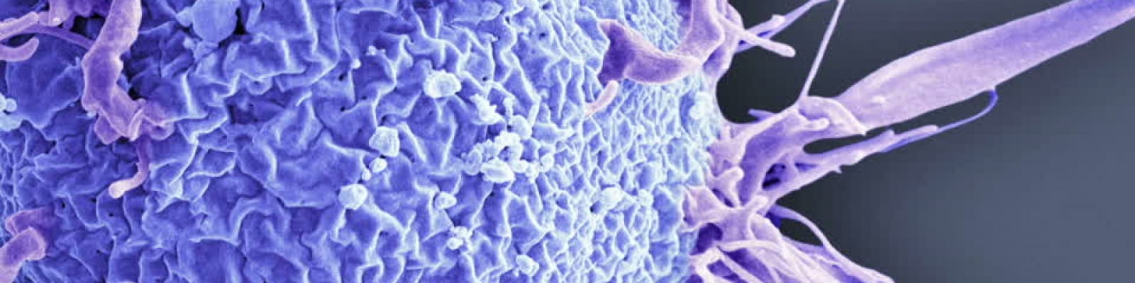 cancer cellule maligne phylum platyhelminthes clasa turbellaria